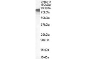Western Blotting (WB) image for anti-Ezrin (EZR) antibody (ABIN5886568) (Ezrin antibody)