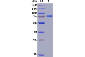 Human OX40 Ligand Protein, mFc-His Tag on SDS-PAGE under reducing condition. (TNFSF4 Protein (mFc-His Tag))