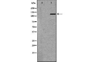 Western blot analysis of extracts of placenta, using NOS3 antibody. (ENOS antibody  (Internal Region))