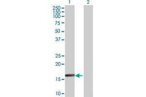 Western Blot analysis of RARRES3 expression in transfected 293T cell line by RARRES3 MaxPab polyclonal antibody. (RARRES3 antibody  (AA 1-164))