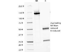 SDS-PAGE Analysis Purified MVP Monoclonal Antibody (Clone 1014). (MVP antibody)