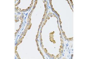 Immunohistochemistry of paraffin-embedded human prostate using CYP19A1 antibody (ABIN5971188) at dilution of 1/100 (40x lens). (Aromatase antibody)