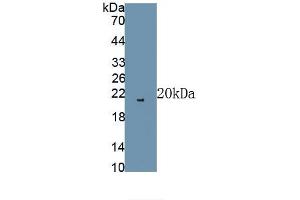 Detection of Recombinant FGF2, Rat using Polyclonal Antibody to Fibroblast Growth Factor 2, Basic (FGF2) (FGF2 antibody)