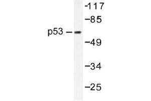 Image no. 1 for anti-Tumor Protein P53 (TP53) antibody (ABIN317853) (p53 antibody)