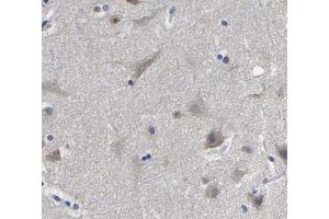 ABIN6269111 at 1/200 staining human brain tissue sections by IHC-P. (HNRNPC antibody  (C-Term))