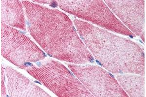 Human Skeletal Muscle (formalin-fixed, paraffin-embedded) stained with ACTA2 antibody ABIN213651 at 5 ug/ml followed by biotinylated goat anti-rabbit IgG secondary antibody ABIN481713, alkaline phosphatase-streptavidin and chromogen. (Smooth Muscle Actin antibody  (N-Term))