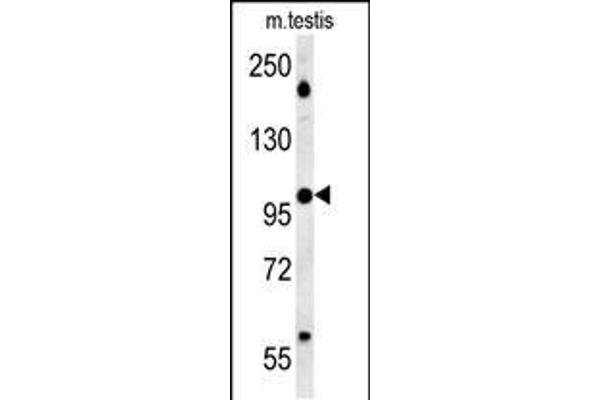 WDR11 antibody  (AA 544-572)