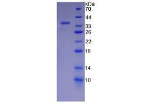 SDS-PAGE (SDS) image for Endoplasmic Reticulum To Nucleus Signaling 1 (ERN1) (AA 571-832) protein (His tag) (ABIN4989267) (ERN1 Protein (AA 571-832) (His tag))