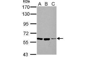 WB Image Sample (30 ug of whole cell lysate) A: NIH-3T3 B: JC C: BCL-1 7. (FZD10 antibody  (N-Term))