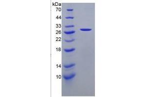 SDS-PAGE (SDS) image for Cathepsin K (CTSK) ELISA Kit (ABIN6574151)