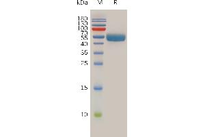 RNF43 Protein (AA 43-197) (Fc Tag)