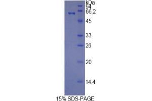 SDS-PAGE (SDS) image for Histidine-Rich Glycoprotein (HRG) ELISA Kit (ABIN6720587)