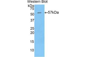 Western blot analysis of the recombinant protein. (THBS4 antibody  (AA 662-923))