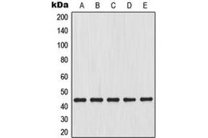 Western blot analysis of MKK4 expression in HeLa (A), HepG2 (B), K562 (C), A431 (D), L929 (E) whole cell lysates. (MAP2K4 antibody  (Center))