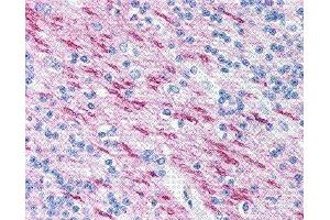 Immunohistochemistry (IHC) image for anti-Myelin Basic Protein (MBP) (AA 84-89) antibody (ABIN2475508) (MBP antibody  (AA 84-89))