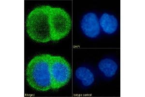 Immunofluorescence staining of MCF7 cells using anti-c-erbB-2  FWP51. (Recombinant ErbB2/Her2 antibody)