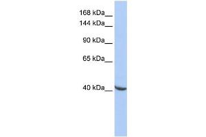 Western Blotting (WB) image for anti-Pogo Transposable Element with ZNF Domain (POGZ) antibody (ABIN2457994) (POGZ antibody)