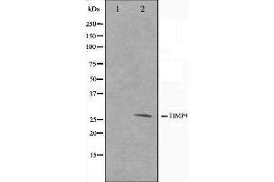 Western blot analysis on NIH-3T3 cell lysate using TIMP4 Antibody,The lane on the left is treated with the antigen-specific peptide. (TIMP4 antibody  (C-Term))