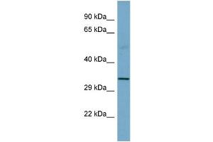Host:  Rabbit  Target Name:  SGCB  Sample Type:  Fetal Small Intestine lysates  Antibody Dilution:  1. (SGCB antibody  (Middle Region))