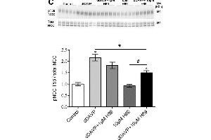 Western Blotting (WB) image for anti-Solute Carrier Family 12 (Sodium/Chloride Transporters), Member 3 (SLC12A3) (AA 74-95) antibody (ABIN863201)