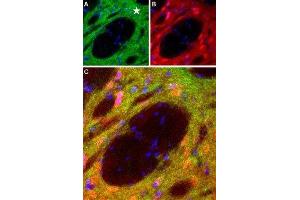 Expression of DRD1 in rat striatum - Immunohistochemical staining of perfusion-fixed frozen brain sections with Anti-D1 Dopamine Receptor Antibody (ABIN7043105, ABIN7044227 and ABIN7044228), (1:100), (green). (Dopamine Receptor d1 antibody  (C-Term, Intracellular))