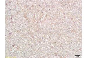Formalin-fixed and paraffin embedded rat brain tissue with labeled Anti-CD38 Polyclonal Antibody, Unconjugated  at 1:200, followed by conjugation to the secondary antibody and DAB staining (CD38 antibody  (AA 101-200))