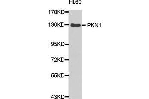 Western Blotting (WB) image for anti-Protein Kinase N1 (PKN1) (AA 1-300) antibody (ABIN6213884) (PKN1 antibody  (AA 1-300))