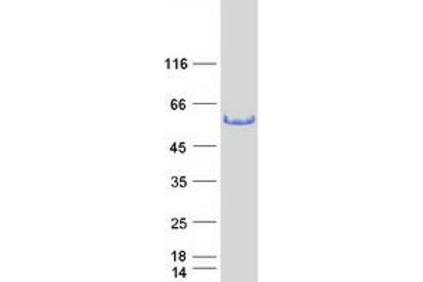 TFG Protein (Transcript Variant 2) (Myc-DYKDDDDK Tag)