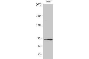 Western Blotting (WB) image for anti-Catenin, beta (CATNB) (Ser29) antibody (ABIN3183685) (beta Catenin antibody  (Ser29))