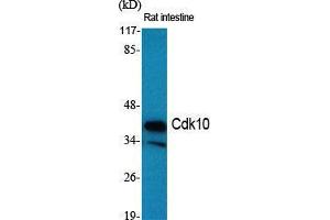 Western Blot (WB) analysis of specific cells using Cdk10 Polyclonal Antibody. (CDK10 antibody  (Internal Region))