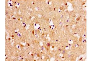 Immunohistochemistry of paraffin-embedded human brain tissue using ABIN7171992 at dilution of 1:100 (TPMT antibody  (AA 4-244))