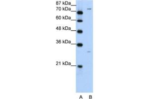 Western Blotting (WB) image for anti-Prostaglandin-Endoperoxide Synthase 1 (Prostaglandin G/H Synthase and Cyclooxygenase) (PTGS1) antibody (ABIN2462481) (PTGS1 antibody)