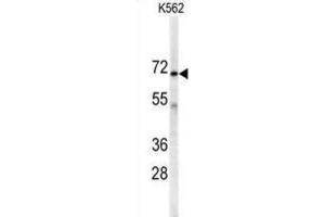 Western Blotting (WB) image for anti-Adenylate Kinase 7 (AK7) antibody (ABIN3002976) (Adenylate Kinase 7 antibody)