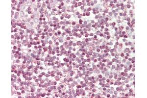 Human Tonsil: Formalin-Fixed, Paraffin-Embedded (FFPE). (TFCP2 antibody  (AA 38-87))