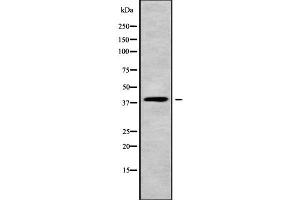 Western blot analysis of WNT4 using Jurkat whole cell lysates (WNT4 antibody  (C-Term))