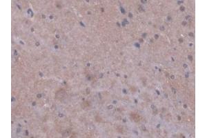 Detection of PPIF in Mouse Cerebrum Tissue using Polyclonal Antibody to Peptidylprolyl Isomerase F (PPIF) (PPIF antibody  (AA 44-192))