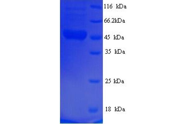 FUS Protein (AA 137-574) (His tag)