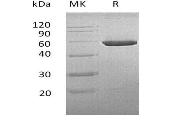 CNDP2 Protein (His tag)