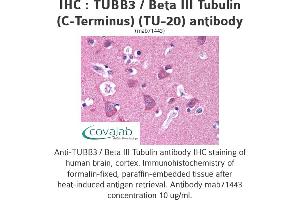 Image no. 2 for anti-Tubulin, beta 3 (TUBB3) (N-Term) antibody (ABIN1724161) (TUBB3 antibody  (N-Term))