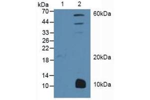 Western blot analysis of (1) Human MCF7 cells and (2) Mouse Liver Tissue. (PPARG antibody  (AA 349-488))