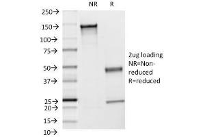 SDS-PAGE Analysis Purified CD54 Monoclonal Antibody (F4-31C2). (ICAM1 antibody)