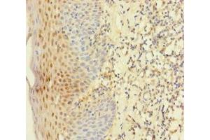 Immunohistochemistry of paraffin-embedded human tonsil tissue using ABIN7145011 at dilution of 1:100 (YME1L1 antibody  (AA 1-240))