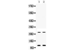 Western blot analysis of Prokineticin 1 expression in mouse liver extract (lane 1) and mouse spleen extract (lane 2). (Prokineticin 1 antibody  (AA 20-105))