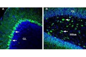 Expression of Homer2 in mouse cerebellum and rat hippocampus - Immunohistochemical staining of perfusion-fixed frozen mouse and rat brain sections with Anti-Homer2 Antibody (ABIN7043274, ABIN7045170 and ABIN7045171), (1:200), followed by goat-anti-rabbit-AlexaFluor-488. (HOMER2 antibody  (C-Term, Intracellular))