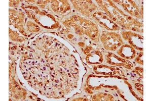 IHC image of nme1HU diluted at 1:10 and staining in paraffin-embedded human kidney tissue performed on a Leica BondTM system. (Histone H1-Like (LOC107807853) (AA 8-20) antibody)