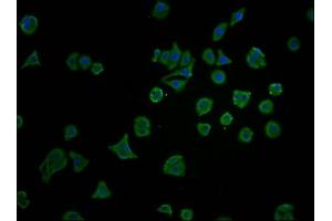 Immunofluorescence staining of HepG2 cells with ABIN7172751 at 1:100, counter-stained with DAPI. (YAP1 antibody  (AA 155-504))