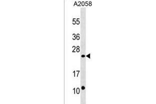DUSP13 antibody  (C-Term)