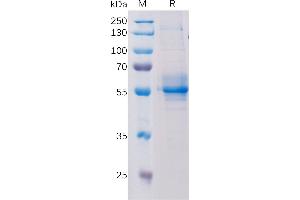 Human T Protein, hFc Tag on SDS-PAGE under reducing condition. (STING/TMEM173 Protein (Fc Tag))