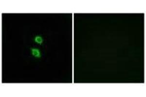 Immunofluorescence analysis of MCF-7 cells, using ARSD antibody. (Arylsulfatase D antibody)