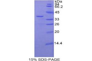 SDS-PAGE analysis of Mouse zAP70 Protein. (ZAP70 Protein)